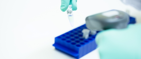 TAmiRNA’s osteomiR™ and thrombomiR™microRNA qPCR laboratory testing service